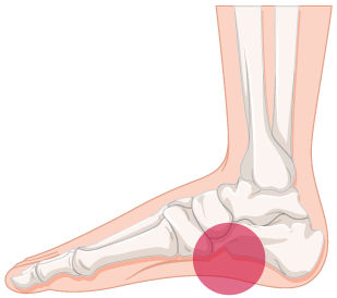 foot arch support for flat feet